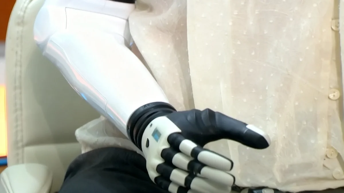 Woman With AI Limb Calls Herself '20% Robot'